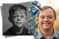 Down Syndrome Male Bundle
